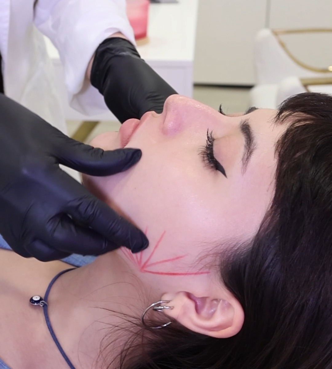 Tratamiento de medicina estética regenerativa en AEVUM CLINIQUE